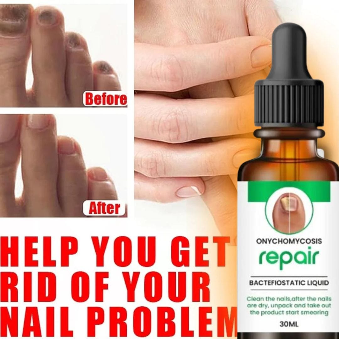 SS All In One Nail Serum 🔥 All Doctors 1st Choice 🔥(Buy 1 Get 1 Free)