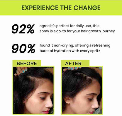 Rosemary Water Hair Spray For Regrowth-🔥Doctor's Choice 🔥(Buy1 Get2 Free😍)