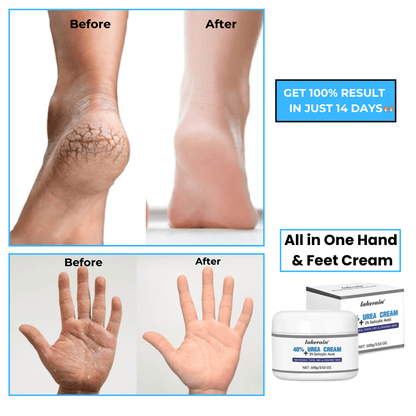 SS All in One Hand & Feet Cream – Intense Hydration for Cracked Skin In 14 Days 💧