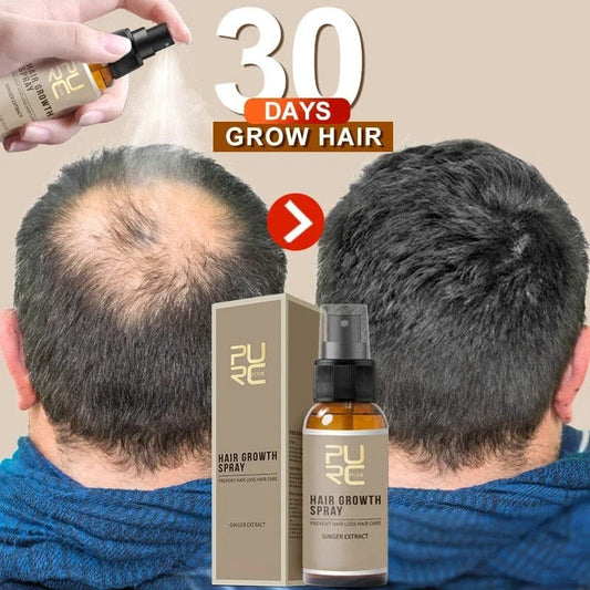 SHO Hair Growth Spray – Infused with Ginger & Angelica Extract 💧