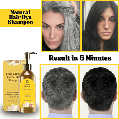 SC SHO Japanese Herbal Hair Dye Shampoo – Instantly Covers Grays in 5 Minutes! 🔥