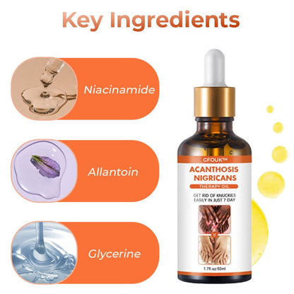 SC SHO Acanthosis Nigricans Oil – Fade Dark Patches, results in 14 days 🌟