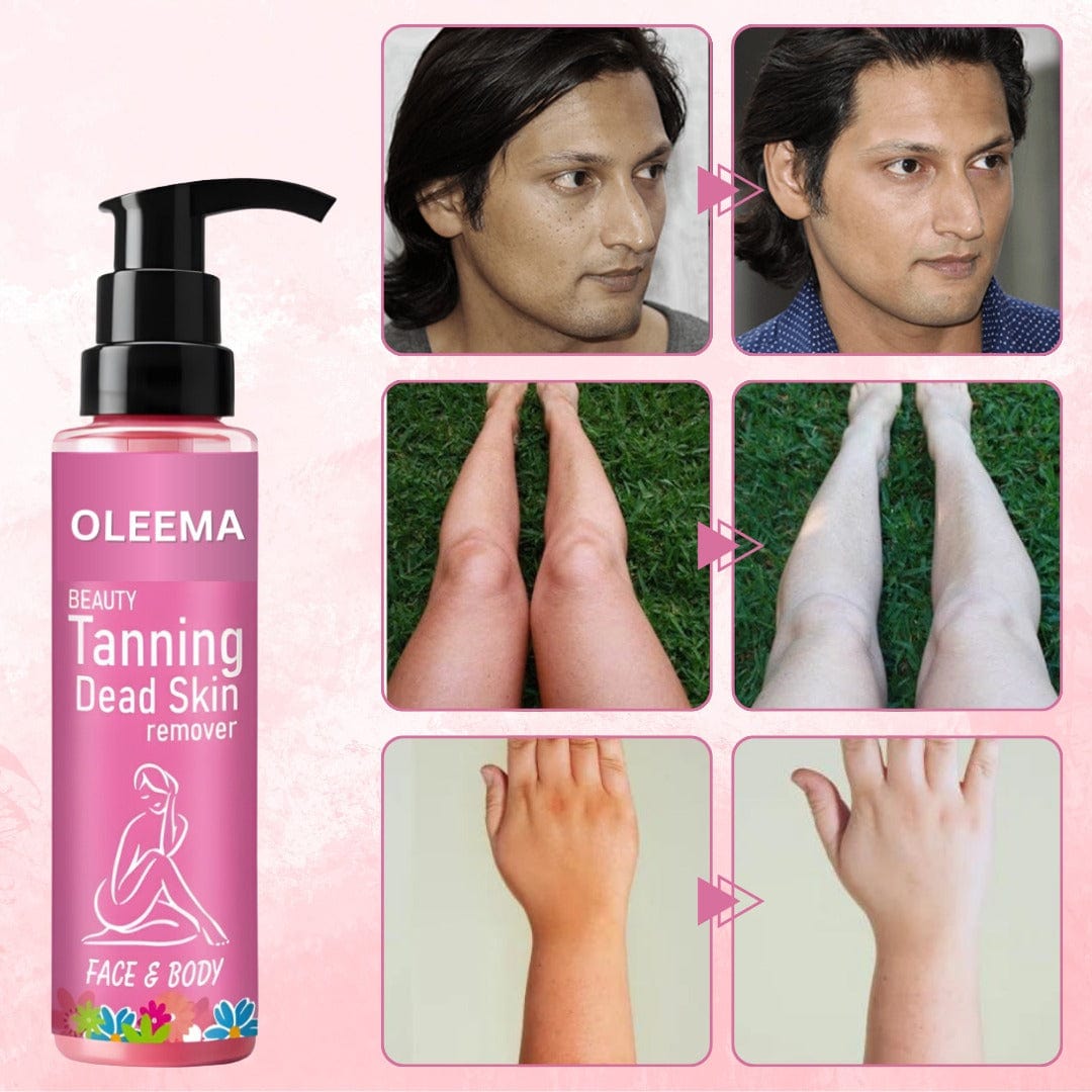 Oleema Beauty Tanning Dead Skin Remover-🔥Buy 1 Get 1 Free 🔥(100% Money Back)