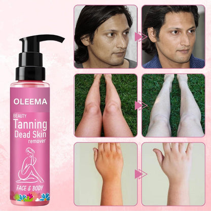 Oleema Beauty Tanning Dead Skin Remover-🔥Buy 1 Get 1 Free 🔥(100% Money Back)