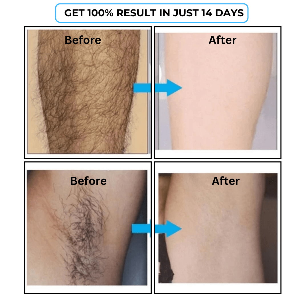 SC-SHO Hair Inhibitor Serum – Effortless Hair Reduction 💧