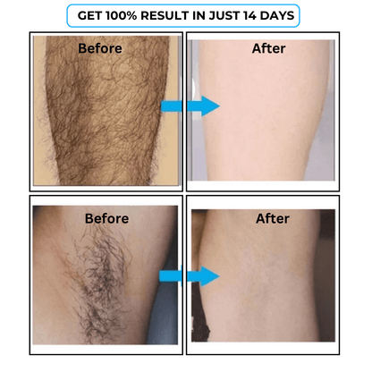 SC-SHO Hair Inhibitor Serum – Effortless Hair Reduction 💧