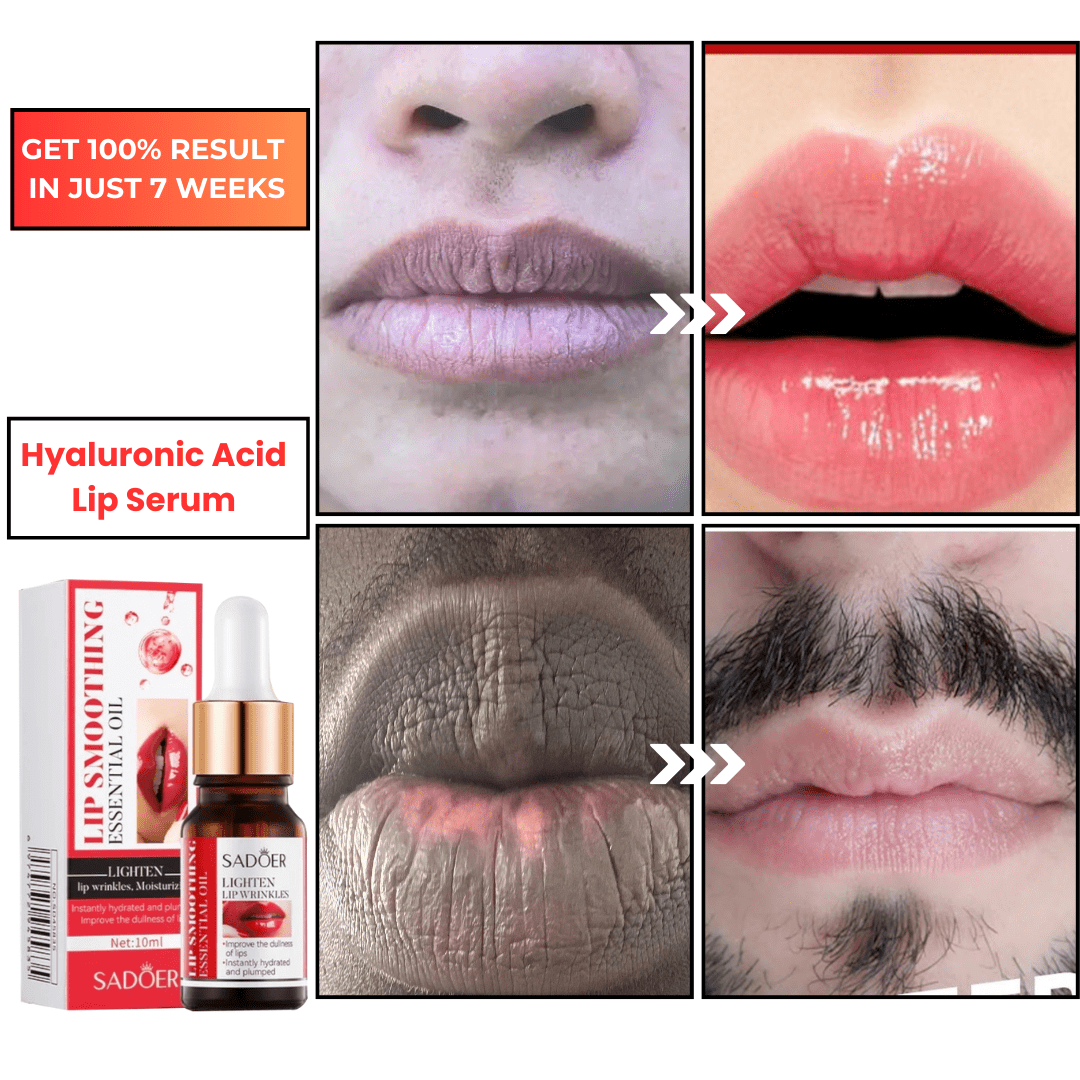 SC SHO Hyaluronic Acid Lip Serum – Your Secret to Plumper Lips in 7 days 💋