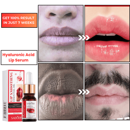 SC SHO Hyaluronic Acid Lip Serum – Your Secret to Plumper Lips in 7 days 💋