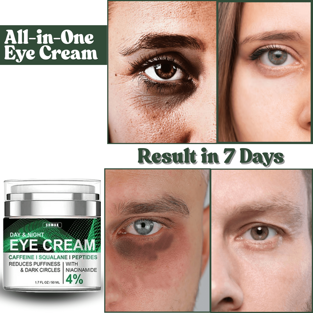 SC SHO All-in-One Eye Cream - Say Goodbye to Puffiness & Wrinkles! in 7 days💖