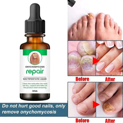 All In One Nail Serum 🔥 All Doctors 1st Choice 🔥(Top Rated)-@249