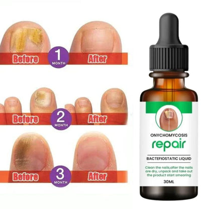 All In One Nail Serum 🔥 All Doctors 1st Choice 🔥(Top Rated)-@249