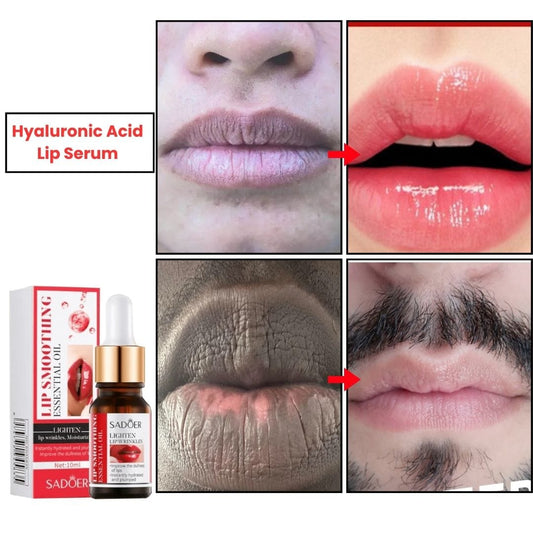 SHO Hyaluronic Acid Lip Serum – Your Secret to Plumper Lips! 💋