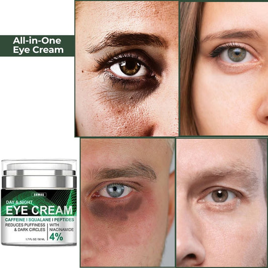 SHO All-in-One Eye Cream - Say Goodbye to Puffiness & Wrinkles! 💖