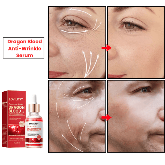 SHO Dragon Blood Anti-Wrinkle Serum – Firm, Lift & Rejuvenate! 🐉