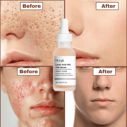 SC-SHO Pore Perfecting Serum – Korean 🇰🇷 Secret Formula Results in 7 Days🌿