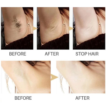 ✨ MS- Hair Inhibitor – Say Bye to Unwanted Hair! ✨BUY 1 GET 1 FREE! 🔥