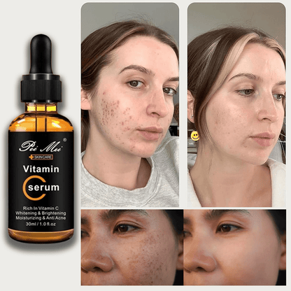SHO-SC Ultra Glow Vitamin C Serum with Korean Anti-Aging Formula🌿