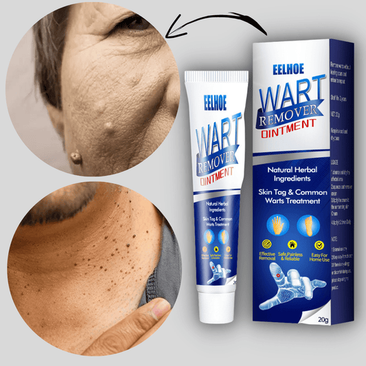 Instant Warts Remover Ointment Cream🌵- Doctor's No 1 Choice (Buy 1 Get 1 Free @289)